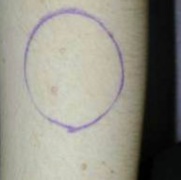 Skine circled in pen.jpg