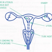 gynaecology diagram.jpg