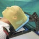 Radiotherapy treatment Face Mask