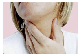 Person with sore throat